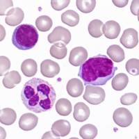 Leucocytes ou globules blancs x400